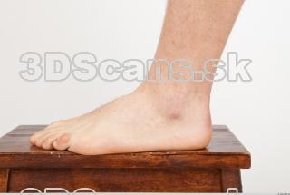 Photo reference of foot 0005